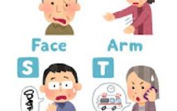 脳卒中～症状編～